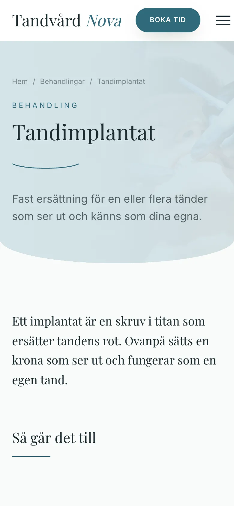 Behandlingssida för tandimplantat i mobilen